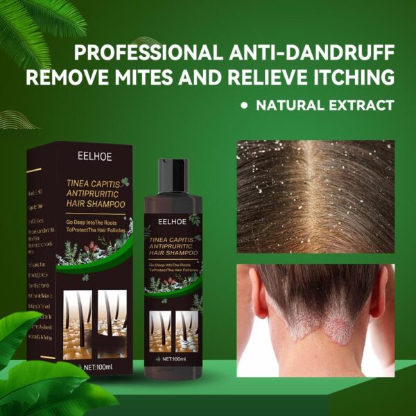 EELHOE Anti-Dandruff Shampoo - Itch Relief, Hair Loss Prevention, Oil Control & Refreshing Care - Image 6