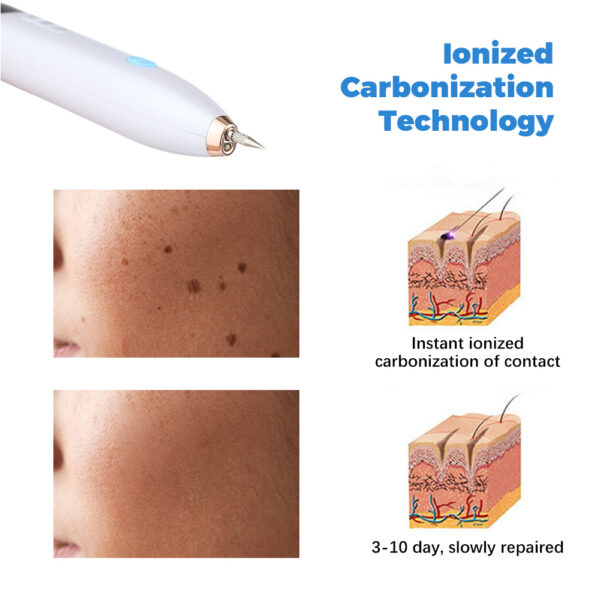 Laser Skin Tag Remover Face Mole Remove Plasma Pen Freckle Removal Machine Plasma Remove Scar Black Spot Face Wart Tattoo Device - Image 6