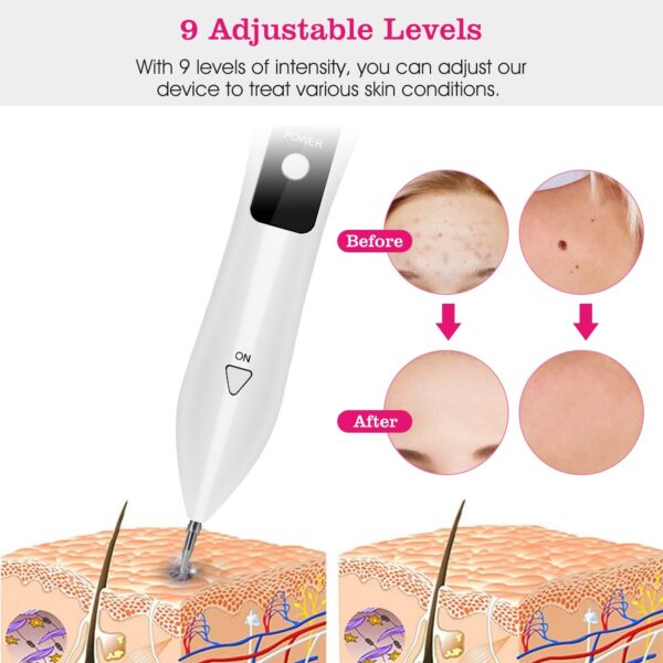 Skin Tag Repair Kit Portable Beauty Equipment Multi-Level With Home Usage USB Charging LCD Level Adjustable 6 Replaceable Needles - Image 10