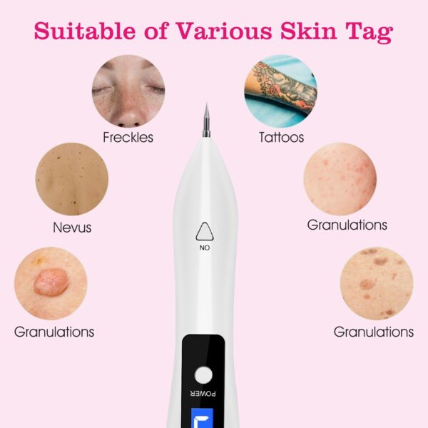 Skin Tag Repair Kit Portable Beauty Equipment Multi-Level With Home Usage USB Charging LCD Level Adjustable 6 Replaceable Needles - Image 7